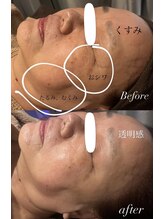 テラ(terra.)/フェイシャル70分