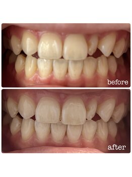 ビューティールームウィズ(beauty room w/)/