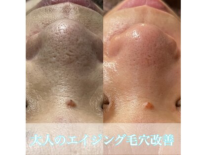 ビエン(bien)の写真