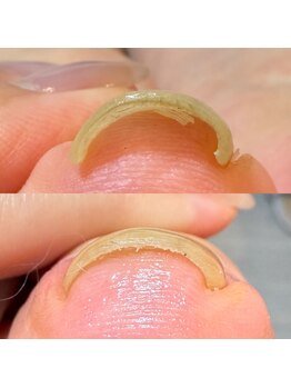 ロイヤル ネイルサロン(Royal nail Saloon)/巻き爪ケア