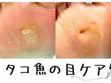 巻き爪補正店 大和店の雰囲気（タコ、魚の目も徹底的にケア！不快感・痛みから解放されませんか）