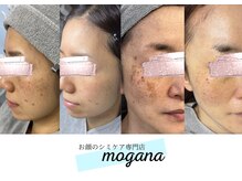 モガナ(mogana)