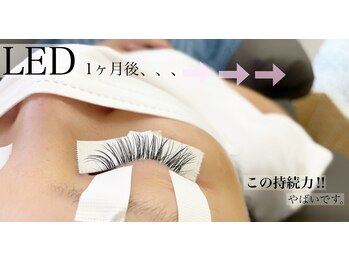 プリュスマイル(+Smile.)/LEDエクステ♪♪装置から1ヶ月後
