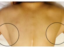 オンリーユータイム(ONLY YOU TIME)/脇のリンパ