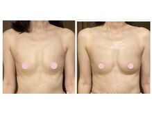 マリール(Marire)/50代・施術6回