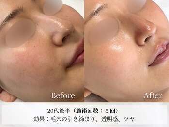 アストリエ グレース 相模大野(Astorie Grace)/継続ケアで肌の質が変わる!