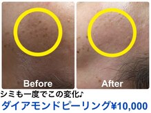 ピュアビューティー(PURE BEAUTY)