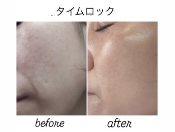 レジュイール(Rejouir)/