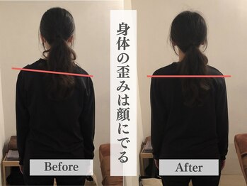 アライメントトウキョウ 恵比寿(Alignment TOKYO)/姿勢矯正(身体の歪み)