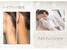 IPL光フェイシャル、脱毛