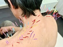 とだ鍼灸院の雰囲気（【首肩こり☆呼吸☆いかり肩】うつむき姿勢！トリガー鍼で楽に♪）