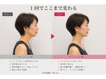 ライフ ピラティス スタジオ(LIFE Pilates Studio)/姿勢が変わると顔の印象も変わる