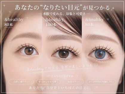シピ(Chipi)の写真