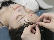 クラリ 徳重院(CLARI)の雰囲気（名古屋、緑区、日進市で美容鍼、ピーリングするならCLARIで♪）