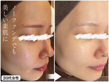 パールホワイトニングサロン 辻堂店の雰囲気（シミケア+素肌も綺麗に◎ 大小問わずケア可能）