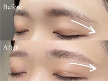 リック(RIC)/困り眉毛の解消◎