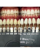 トウキョウスワーズ 池袋店(TOKYO SWRS)/#ホワイトニング #池袋 #渋谷