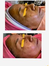 ビビアンローズ(BIBIAN ROSE)/諦めないでチャレンジ