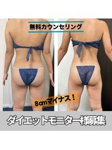 エイビー(ei-B)/【モニター募集】