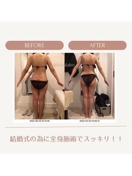 効くラボ 新宿店/ブライダル痩身♪