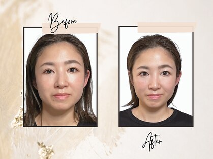 チチ(Chichi)の写真