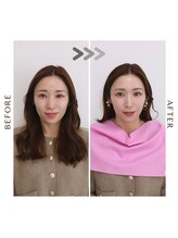 シュアリー(Surely)/トータルコースお客様事例