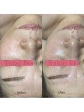 トータルビューティーサロンリア(Li'a)/【60代前半】新メニュー