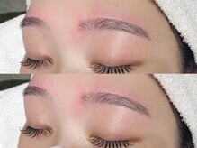 アイクイック(Ai Quick)/レディースワックス脱毛