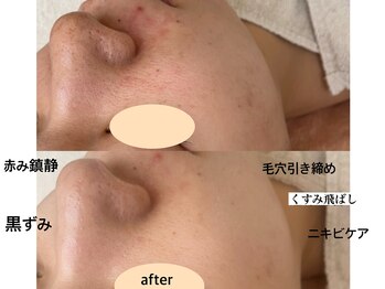 ドゥクス 難波店(Dux)/タラソトリートメント