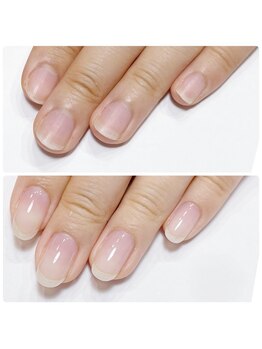 イマイロ(Imairo)/自爪育成クリア/ハンドケア