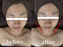 オアシス 西新井店(Oasis)/30代女性ウルトラフェイシャル