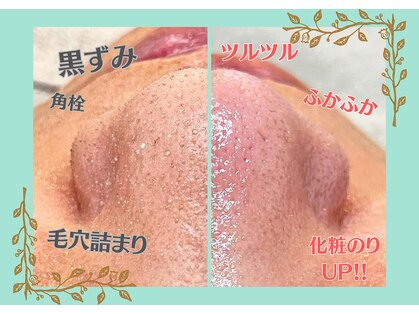 ネクサス(NEXUS)の写真