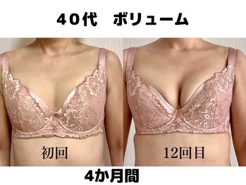 バストサロン メルベイユ(Merveile)/ボリューム、谷間UPで立体感UP