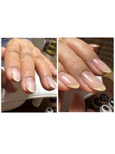 エイティピカル(Atypical)/美フォルムクリア