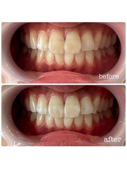 ビューティールームウィズ(beauty room w/)/