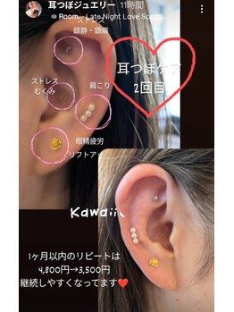 アロマヒル(ARO-MAHIR)/継続するほど整いやすい耳つぼ
