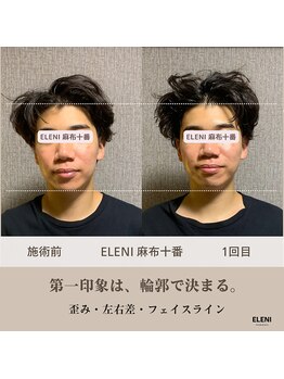 エレーニ 麻布十番(ELENI)/左右差にアプローチ、整った輪郭