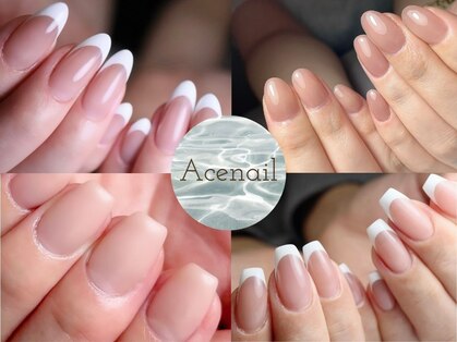 Acenailの写真