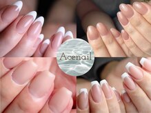 エースネイル(Acenail)