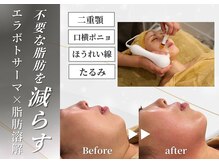 トロワ(TROIS)の雰囲気(結果重視☆専門知識を有するスタッフの信頼の施術!長野市/小顔)