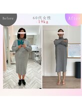 メモリア(memoria)/ダイエット　before/after