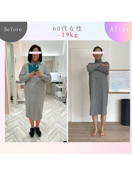 メモリア(memoria)/ダイエット　before/after