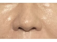 ベル(Bell)/ツルツルつや肌