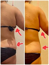 ヨサパーク エスポワール 三木店(YOSAPARK Espoir)/劇的変身コースビフォーアフター