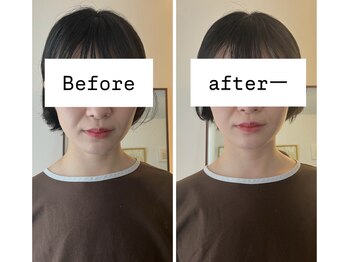 リモド(Rimodo509)/小顔矯正(ヘッドスパ