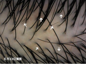 エルプラス(L+)/新毛ぞくぞく発見！