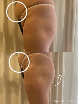 エクラ(eclat)/セルクラ