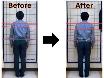 富沢駅前整骨院/姿勢分析で原因を探ります!