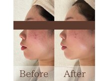 凪眠の雰囲気（ビフォーアフター写真はブログ、フォトギャラリーに多数掲載中！）