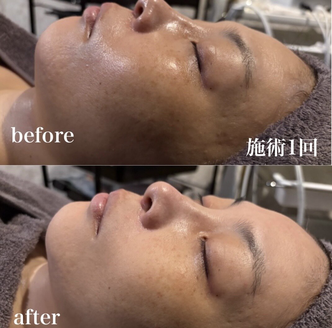 サロン ド エーアンドアイ(SALON de A&I)｜ホットペッパービューティー